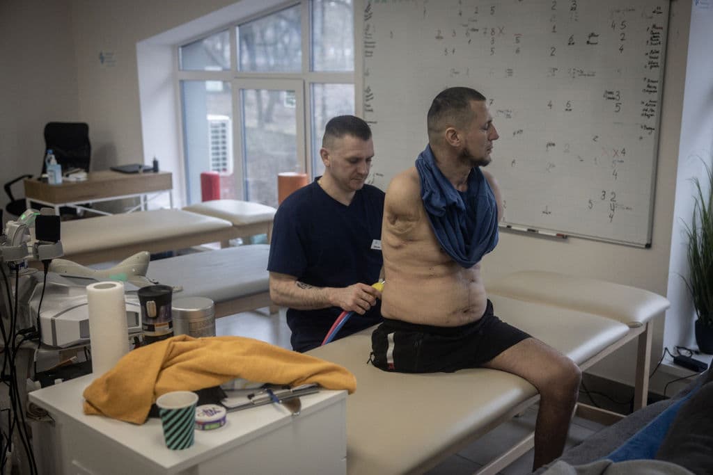 Oleksandr, un soldado de 43 años triplemente amputado, en una clínica de rehabilitación en Kiev, Ucrania. El 24 de febrero de 2024 se cumplieron dos años desde la invasión de Rusia a Ucrania, que ha dejado decenas de miles de muertos, aunque ninguno de los dos países publica cifras oficiales de bajas. La guerra también ha provocado inseguridad económica en el mundo, ha aislado a Rusia de Occidente y, aunque inicialmente unificó a los 
<a href="https://www.univision.com/noticias/estados-unidos/atacms-moscu-advierte-a-eeuu-sobre-el-permiso-a-ucrania-para-usar-sus-misiles-sobre-rusia-esta-echando-lena-al-fuego">países de la OTAN,</a> ha expuesto tensiones entre los aliados occidentales sobre la escala y la duración del apoyo militar a Ucrania.
