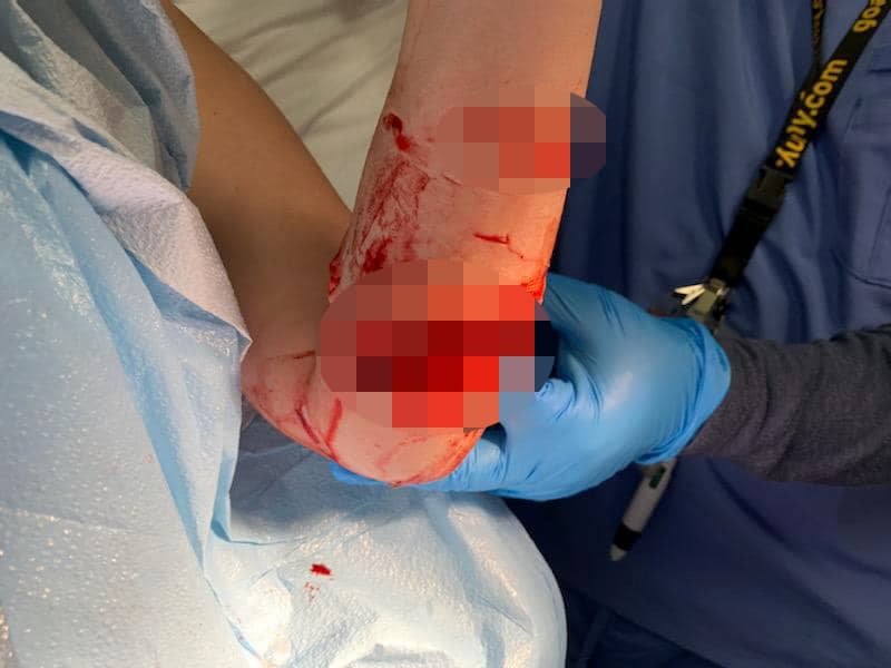 Anteriormente se reportó otro un incidente similar.
<br>