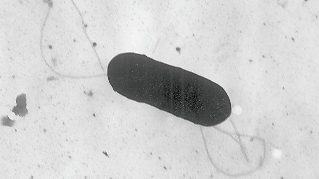 Nueva York es el estado con más reportes de listeria en un brote que ha dejado dos muertos