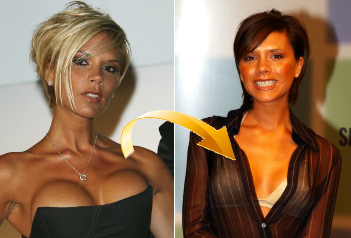 La ex Spice Girl pasó a ponerse 'boobs', afilarse el rostro y acomodarse un poquito la nariz.