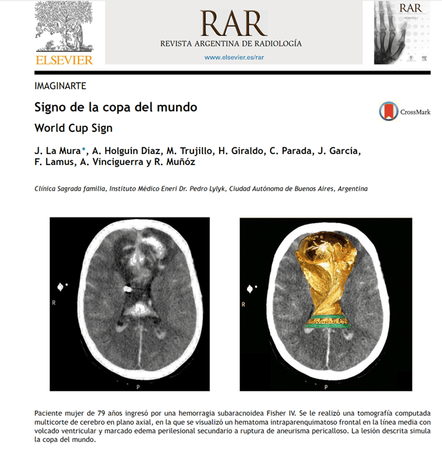 Holguín Díaz firmó este estudio comparativo de una hemorragia y la copa mundial de futbol. 
<br>