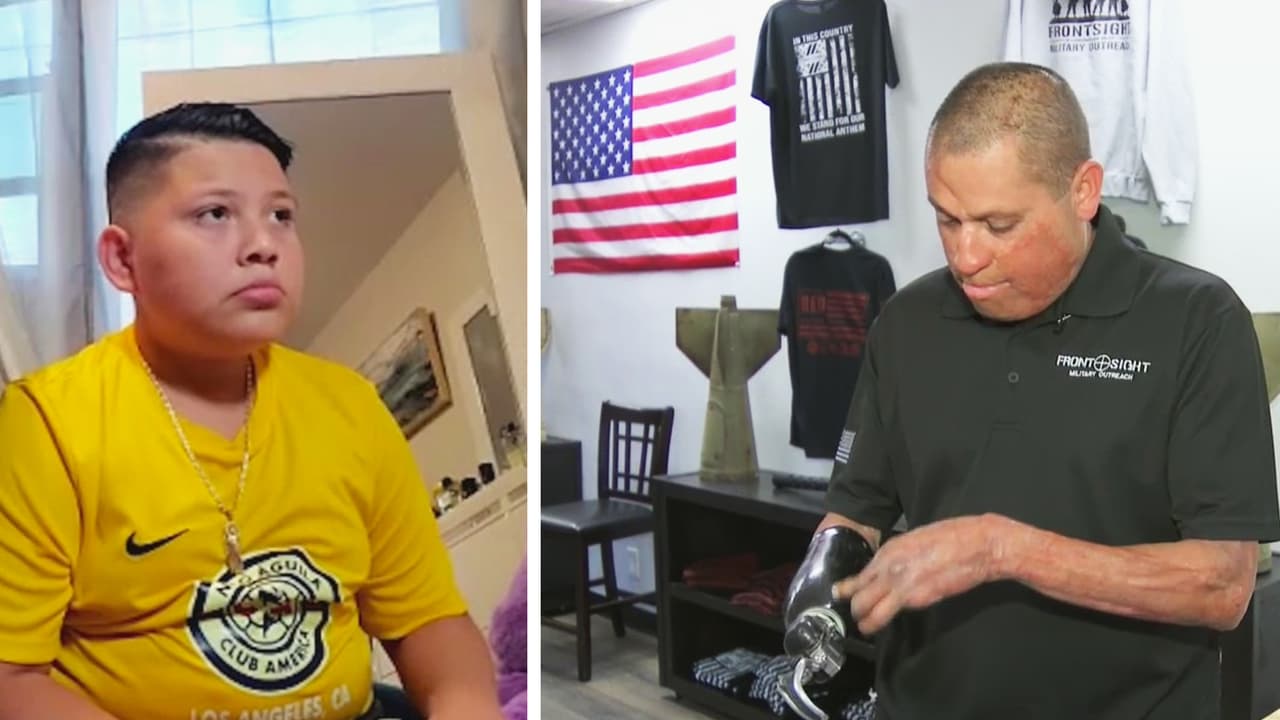 Octavio Sánchez, un soldado que perdió el brazo derecho en medio del combate en Irak, habla de su experiencia y de cómo intenta ayudar a compañeros que atraviesan situaciones similares tras desarrollar PTSD (Post-Traumatic Stress Disorder), una enfermedad mental que suele presentarse cuando se ha sufrido un trauma severo y que es capaz de causar pesadillas, ansiedad y depresión. Por su parte, Harón Carreto, padre de un niño víctima de la pirotecnia, relata cómo cambió la vida de su hijo luego de que un cohete le arrancara la mano izquierda.