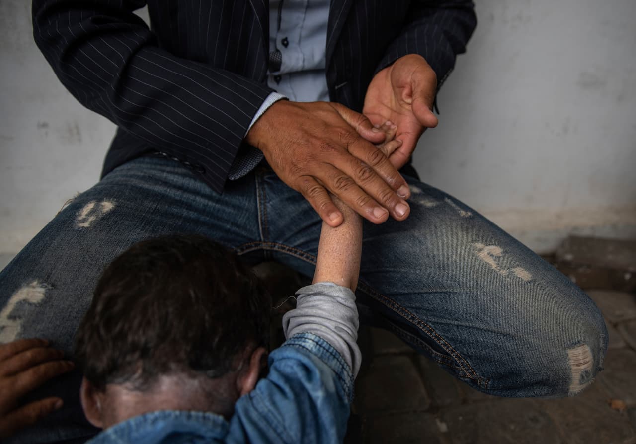 Ghazaoui dirige la Asociación para la Solidaridad con los Niños de la Luna desde su casa en la ciudad de Mohammedia. Hace malabares en su tiempo libre entre sus visitas a las familias, distribuir donaciones de cremas y máscaras, proporcionar datos al hospital de Casablanca y presionar al gobierno para que tome medidas.