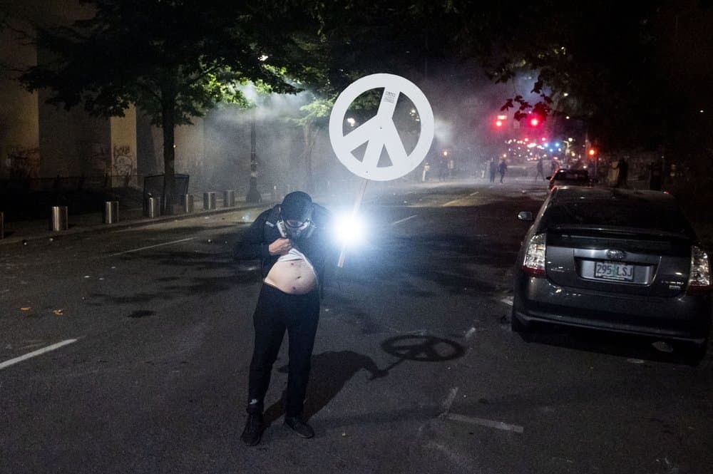 Este manifestante muestra las heridas de perdigones que le quedaron en su cuerpo. El secretario interino de Seguridad Nacional, Chad Wolf, dijo el pasado jueves que las autoridades estatales y municipales tienen la culpa de no poner fin a las protestas en Portland, enojando a los funcionarios locales.