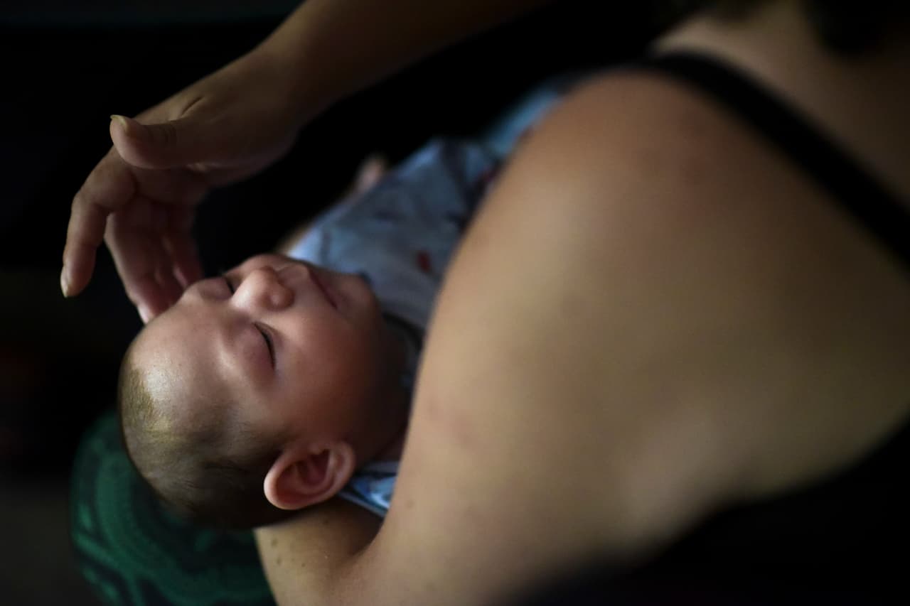 5% de las embarazadas de EEUU que se infectaron con zika tuvieron bebés con defectos de nacimiento