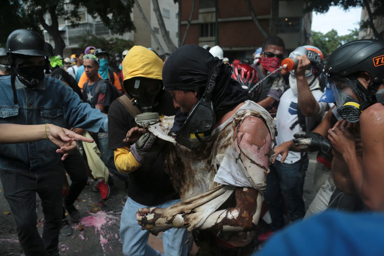 He was immediately helped by his fellow protesters, who put out the fire and transported him to a municipal clinic. May 3, 2017
