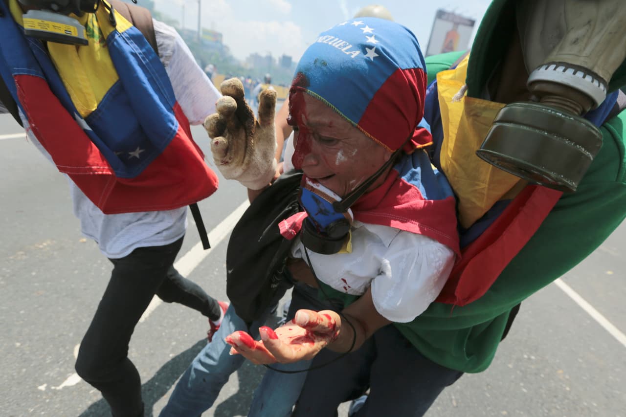 Una activista herida en la cabeza es asistida por sus compañeros en la protesta. 26 de abril de 2017.