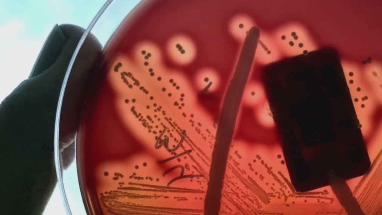 Bacteria come carne deja al menos cuatro muertos en Florida: te explicamos cómo prevenir el contagio