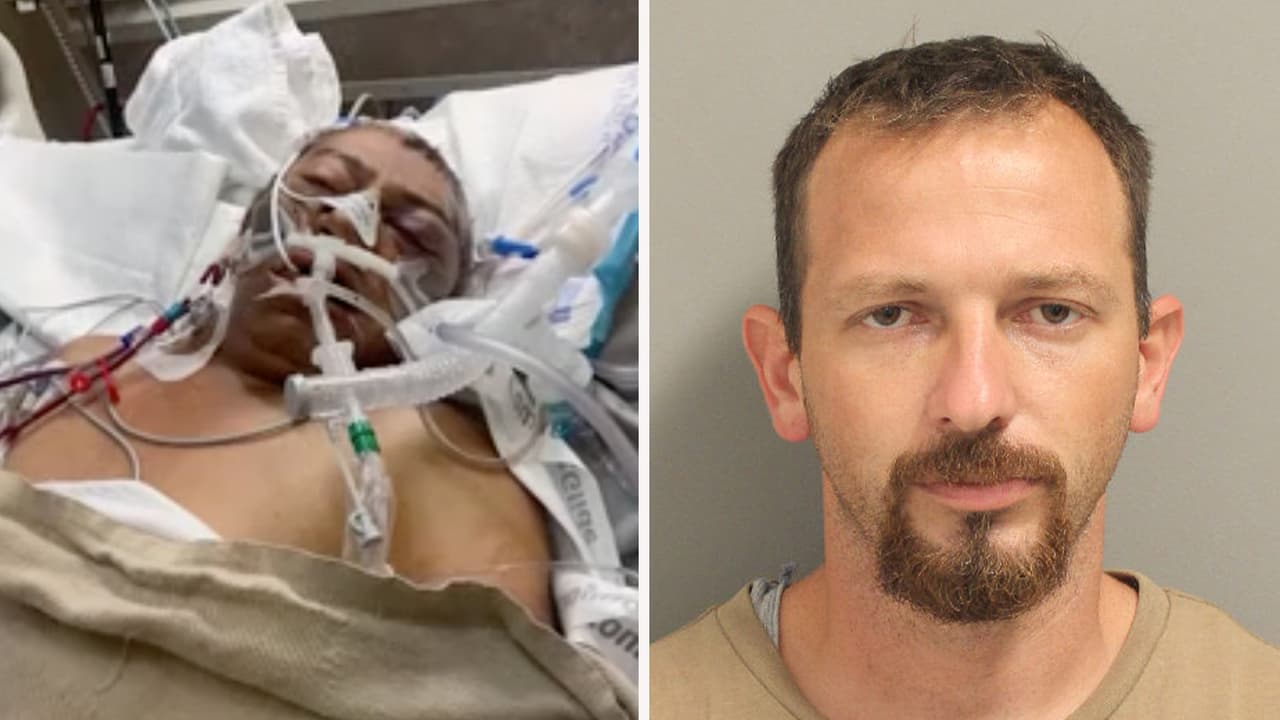 La policía acusó a 
<a href="https://www.univision.com/local/houston-kxln/nicolas-vasquez-ataque-perros-funeral-houston" target="_blank">Matthew Leroy Satchell</a> por el ataque mortal de sus perros 'Oreo', 'Brownie' y 'Donut' a Nicolás Vásquez. El sospechoso salió libre tras pagar una fianza de 20,000 dólares.