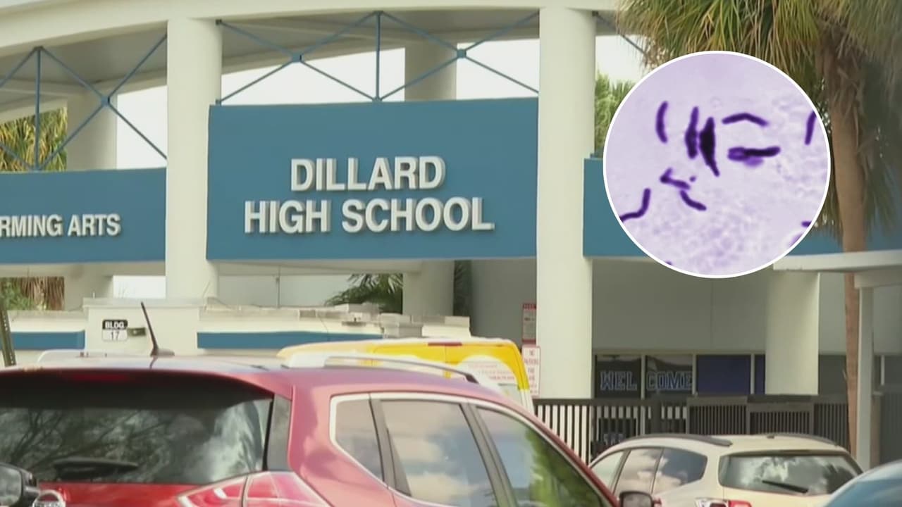 Detectan un caso de tuberculosis en una escuela del sur de la Florida
