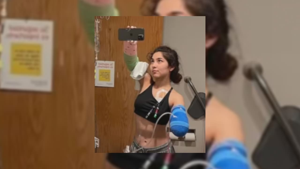 Joven pierde un brazo tras ser atacada en casa por su propia mascota