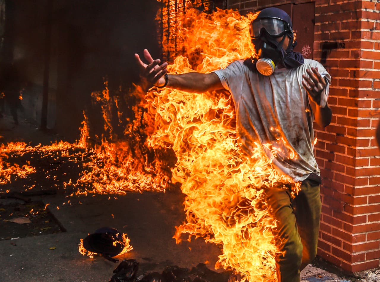 A demonstrator is set alight during a protest in unclear circumstances. He was engulfed after a police motorcycle gas tank exploded, according to one version. Another said he set himself on fire while in possession of a molotoiv cocktail. According to authorities the victim was hospitalized in stable condition. May 3, 2017.
