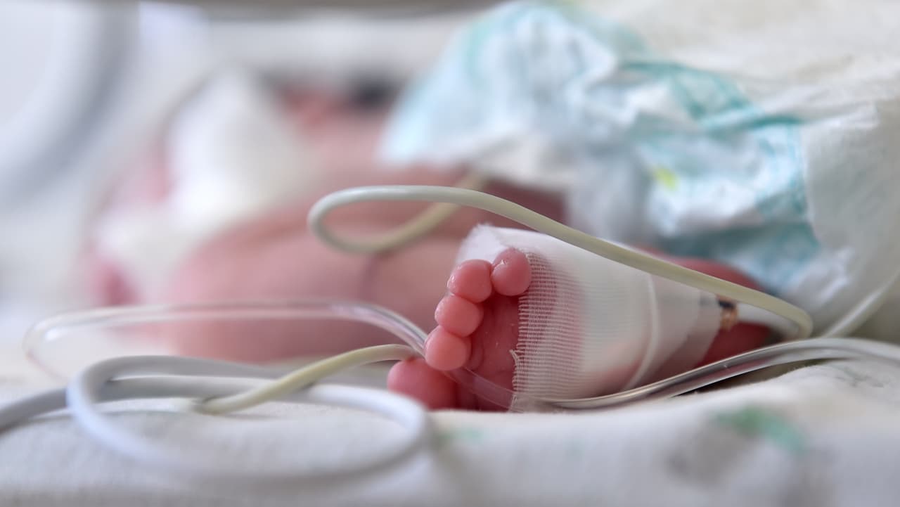 Padres son acusados de abuso infantil tras dejar a su bebé ciego y cuadrapléjico en el condado de Orange
