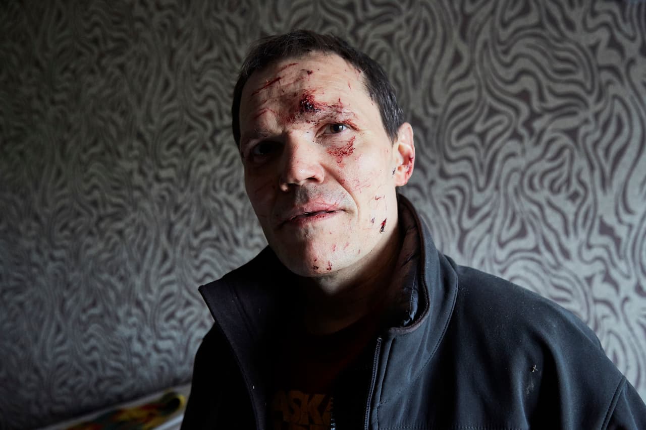 Un ucraniano llamado Vladimir resultó herido cuando su cuarto fue destrozado por un misil ruso el 25 de febrero. 
<br>
<br>Fue fotografiado cuando regresó a rescatar algunas pertenencias. 
<br>