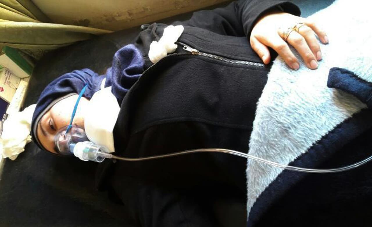 Aya Fadl recibe oxígeno para mitigar las dificultades respiratorias luego del ataque. Había huido de su casa para evitar los gases que envolvían la ciudad de Khan Sheikhoun, junto a su esposo y su hijo de casi dos años. Perdió a más de una decena de miembros de su familia. 5 de abril de 2017.
<br>