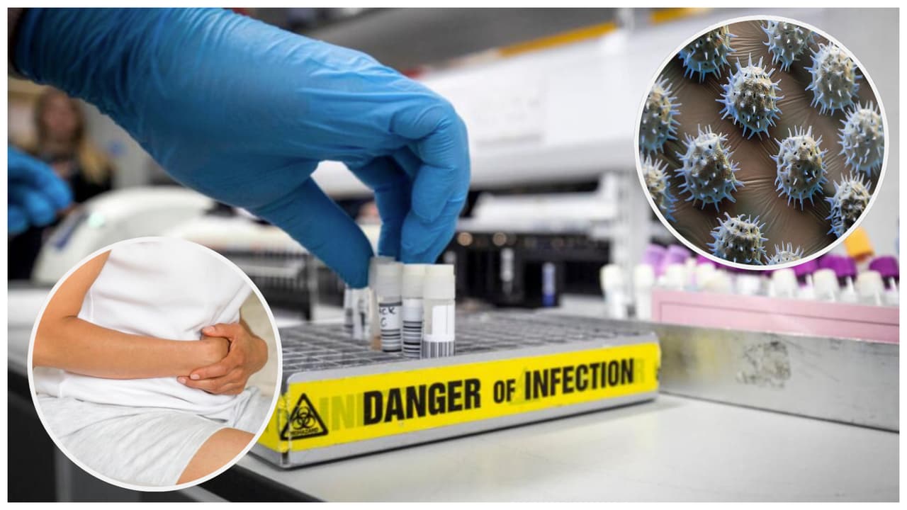 Florida es el segundo estado con más casos de brotes de norovirus en EEUU