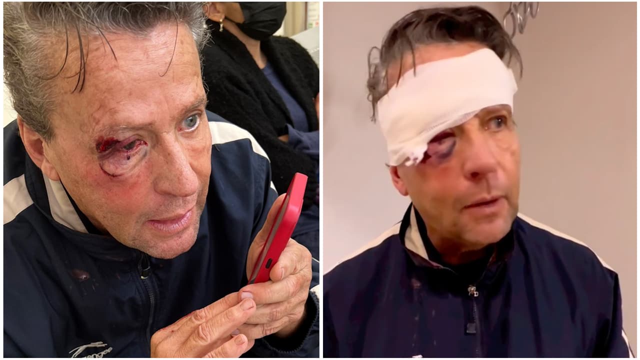 <b>Alfredo Adame</b> recibió una fuerte golpiza el pasado 28 de septiembre. Según indicó el propio actor, fue 
<b>"víctima colateral" de un asesinato </b>que ocurrió muy cerca de domicilio. Dijo que todo sucedió cuando él se acercó al lugar de los hechos con intenciones de ayudar.