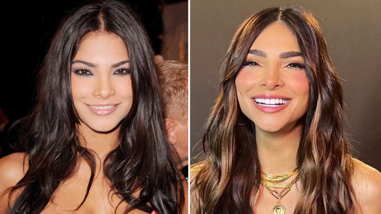 Alejandra Espinoza se someterá a un "diseño de sonrisa” otra vez: “Cambiará muchísimo su rostro”