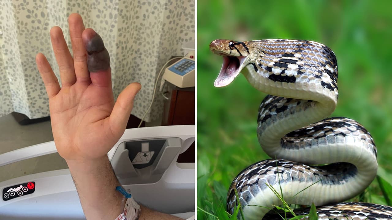 Ciclista intenta ser héroe salvando serpiente venenosa y termina con mordida que casi le cuesta la mano