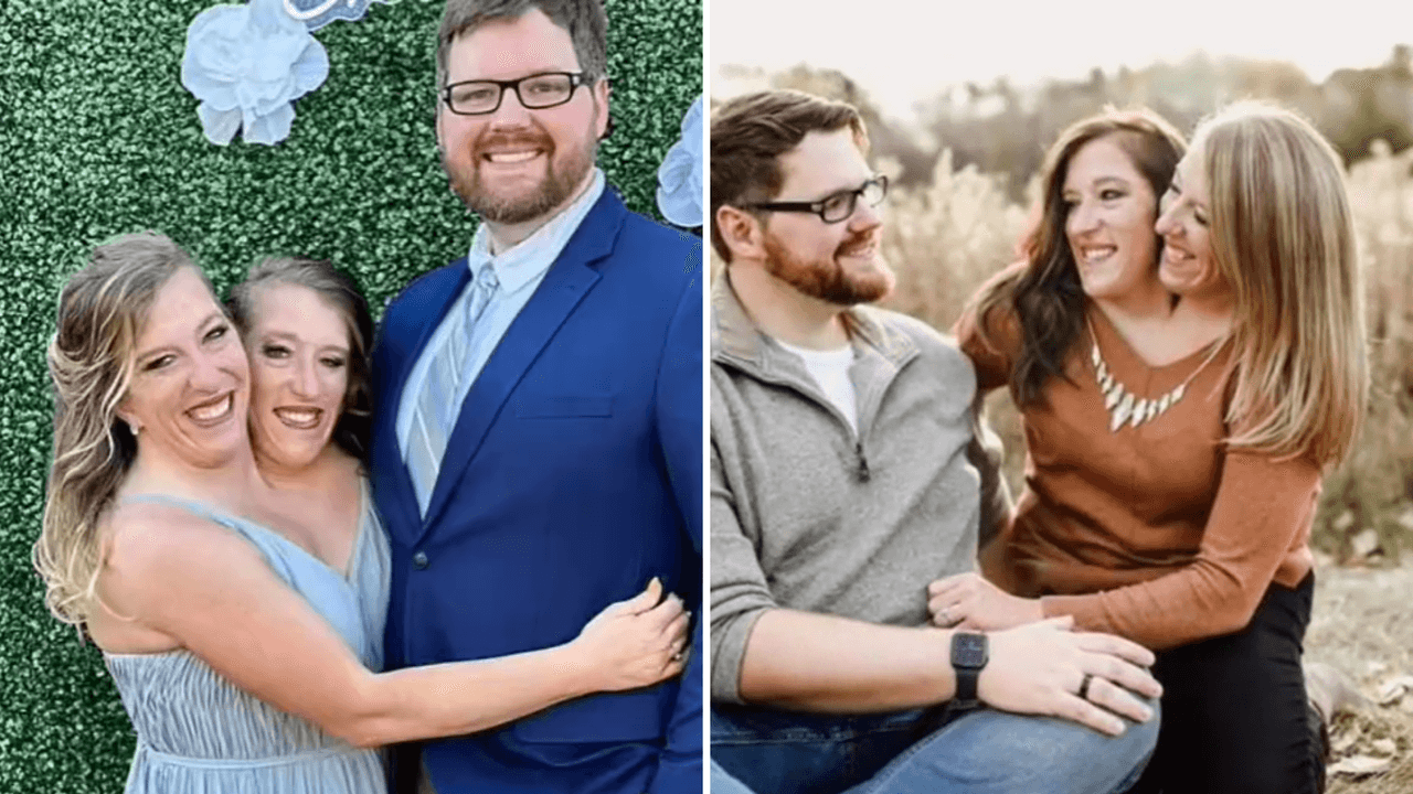 ¿Cómo es la vida de las siamesas Abby y Brittany Hensel? Una de ellas ya se casó