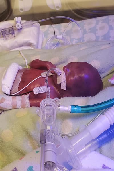 Hutchinson nació en el 
<a href="https://www.childrensmn.org/locations/woodbury/" target="_blank">Children’s Minnesota Hospital</a> el 5 de junio de 2020, 131 días antes de lo esperado y 
<b>lo hizo con solo 11.9 onzas (337 gramos) de peso.</b>