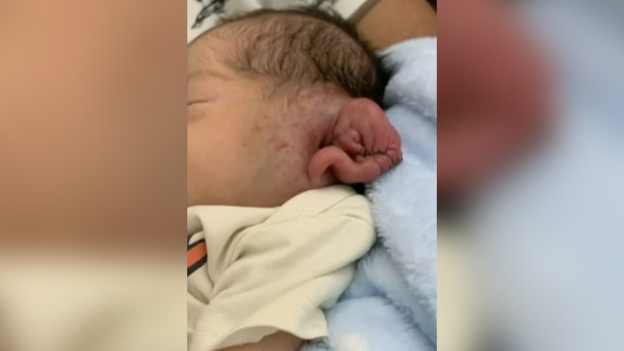 <b>Le cortaron la oreja a un bebé al practicarle la cesárea a su madre durante un apagón</b>
<br>
<br>Karla Urikanzi alega que le practicaron la cesárea con luces de celulares y que, aunque ella se había negado al procedimiento, se lo realizaron poniendo su vida y la del bebé en peligro. El pequeño sufrió una herida en la oreja, la cual presenta inflamación.
