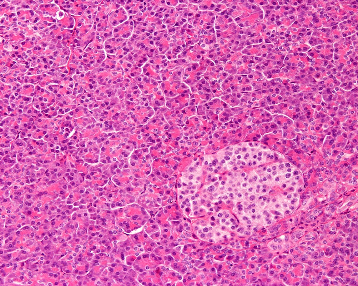 Cada uno de estos parches (llamados islotes) contiene células beta, alfa y delta que son responsables de la secreción de hormonas pancreáticas. 
<a href="https://www.britannica.com/science/islets-of-Langerhans#ref196868" target="_blank">Las células beta secretan insulina</a>, hormona crucial en la regulación del metabolismo de la glucosa. En la foto, ampliación de un islote de Langerhans, esas células diferenciadas del páncreas. 
<br>