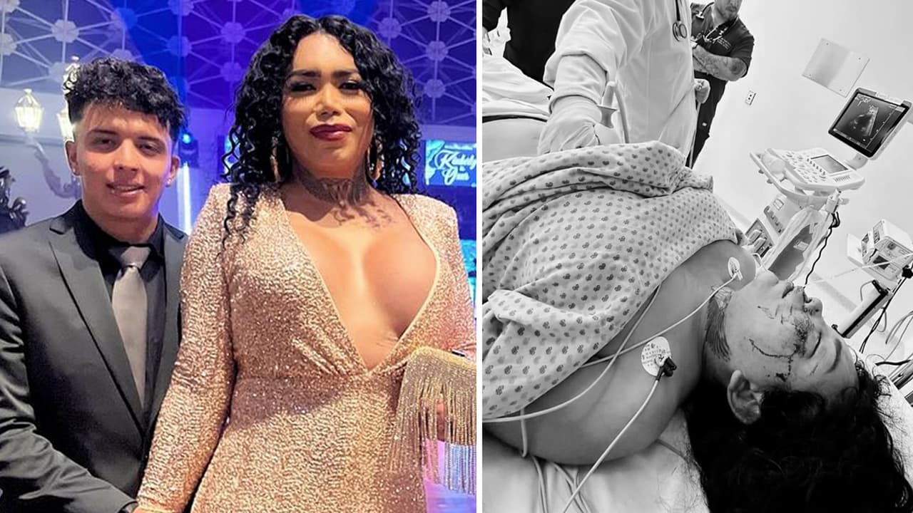 Paola Suárez de 'Las Perdidas' podría perder el ojo: habría sido brutalmente golpeada por su novio