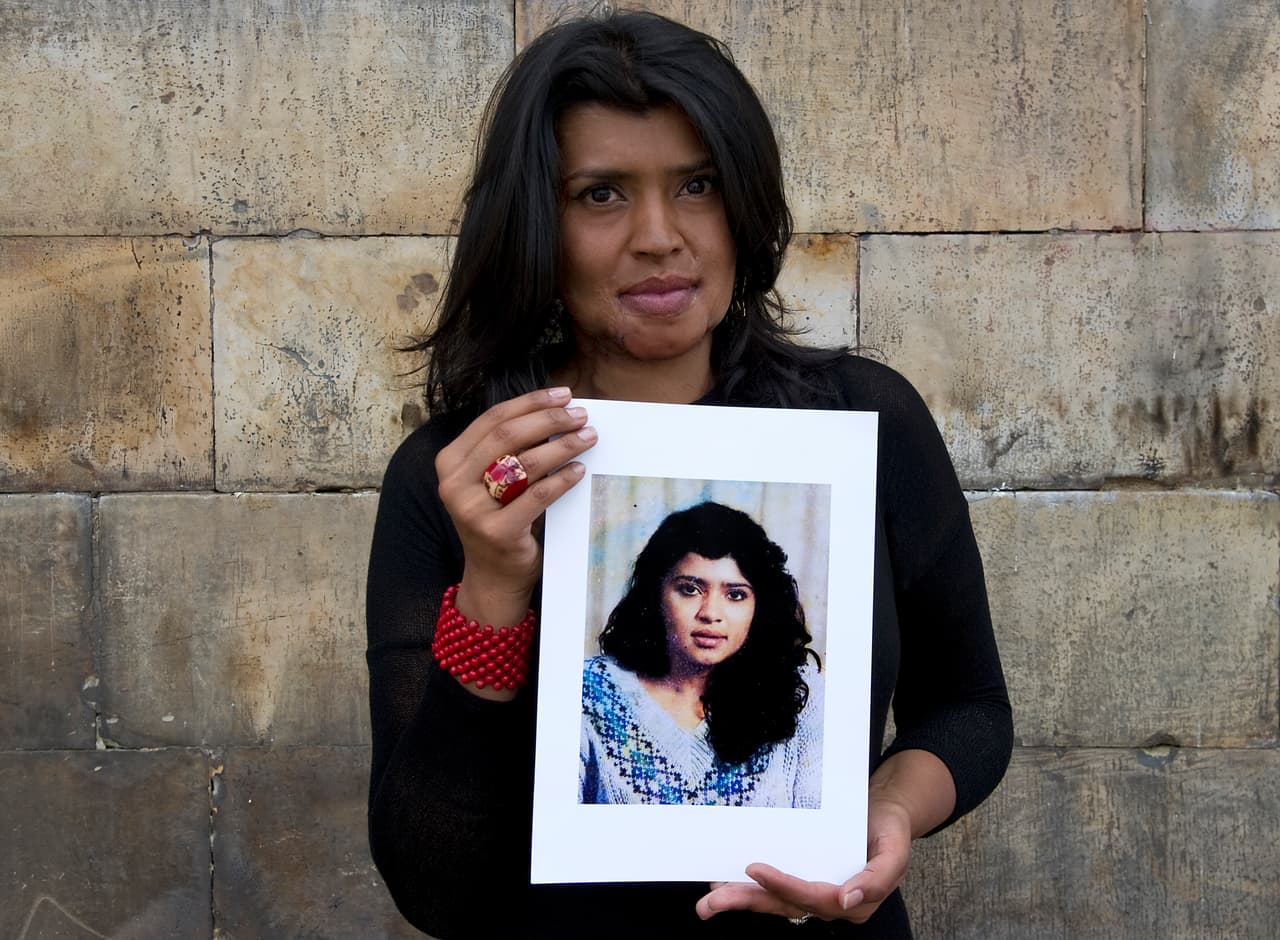 Gina Potes fue atacada con ácido hace 20 años en Colombia. 
<a href="https://www.univision.com/noticias/violencia-de-genero/fui-victima-de-un-ataque-de-acido-y-ahora-ayudo-a-otras-mujeres-a-volver-a-mirarse-al-espejo"><b>"El 28 de octubre de 1996, irrumpieron en mi casa: '¿Quién la mandó a ser tan bonita?', me preguntaron.</b></a> Me arrojaron una sustancia que me quemó gran parte del rostro, del cuello y del cuerpo. Tenía 20 años. En ese momento, la vida te da un giro de 180 grados. Tus sueños e ilusiones de siempre quedan en un segundo plano y empiezan las lágrimas, las tristezas, las depresiones, las ganas de no vivir, las culpas, los remordimientos, las preguntas", le contó recientemente a Univision Noticias. Gina se ha sometido a más de 28 cirugías y 70 procedimientos para reconstruir su rostro y quiere usar sus cicatrices como una herramienta para ayudar a otras mujeres que han sufrido este tipo de violencia.