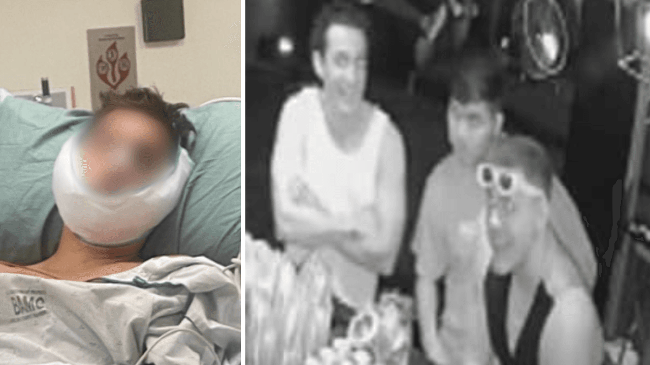 Golpean a joven hispano que defendió a mujer de hombres en un bar y buscan a los sospechosos