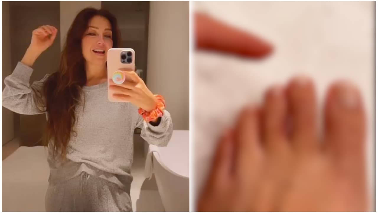 Thalía exhibe cómo quedó el dedo de su pie tras sufrir accidente: "Creo que me lo rompí"