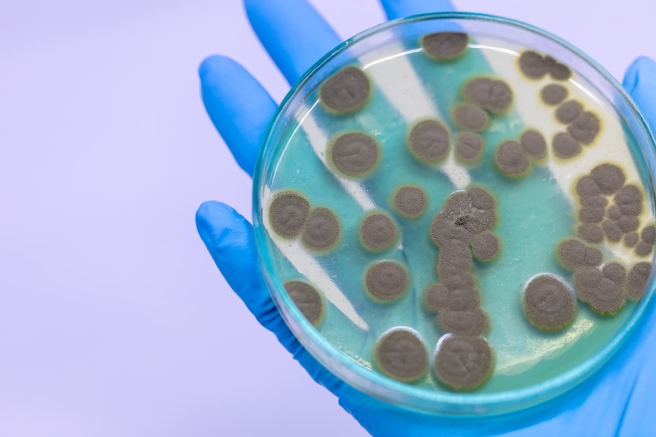 <h3 class="cms-H3-H3">16. Penicilina</h3>
<br>
<br>En septiembre de 1928, el microbiólogo escocés Alexander Fleming regresó a casa de unas vacaciones y halló que el plato petri que había inoculado con un estafilococo se había contaminado con un hongo. 
<br>
<br>Fleming descubrió que las bacterias cercanas al hongo habían muerto y entonces lo nombró como Penicilium Genus, una sustancia antibacterial. 
<br>