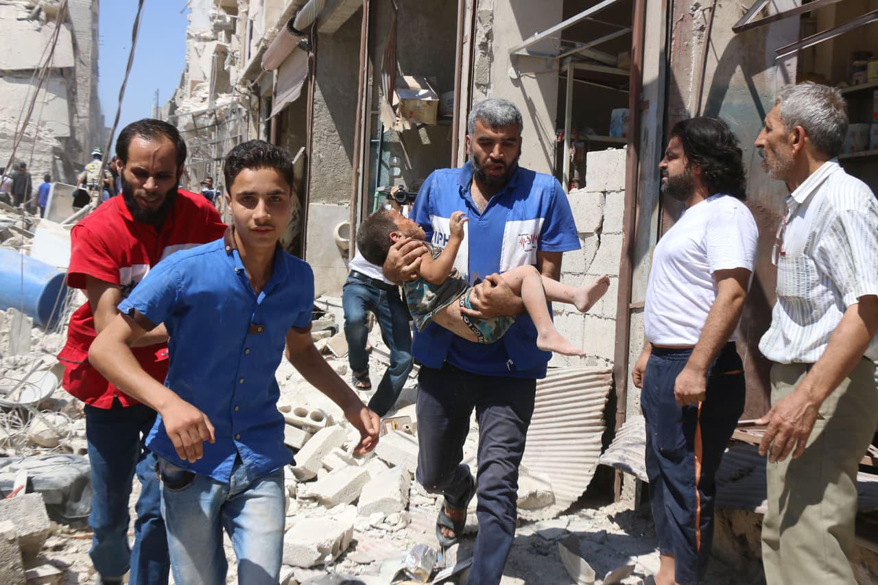 Un niño herido en un ataque sobre ataque aéreo reportado en el barrio de Qatirji, el 23 de julio de 2016. Decenas de civiles murieron en bombardeos ese mismo día en todo el país.
