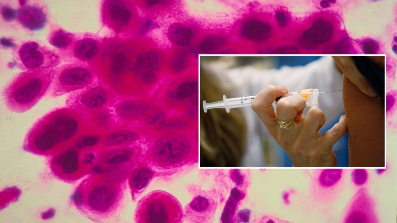 Puedes prevenirlo: consejos para una detección temprana del cáncer de cuello uterino