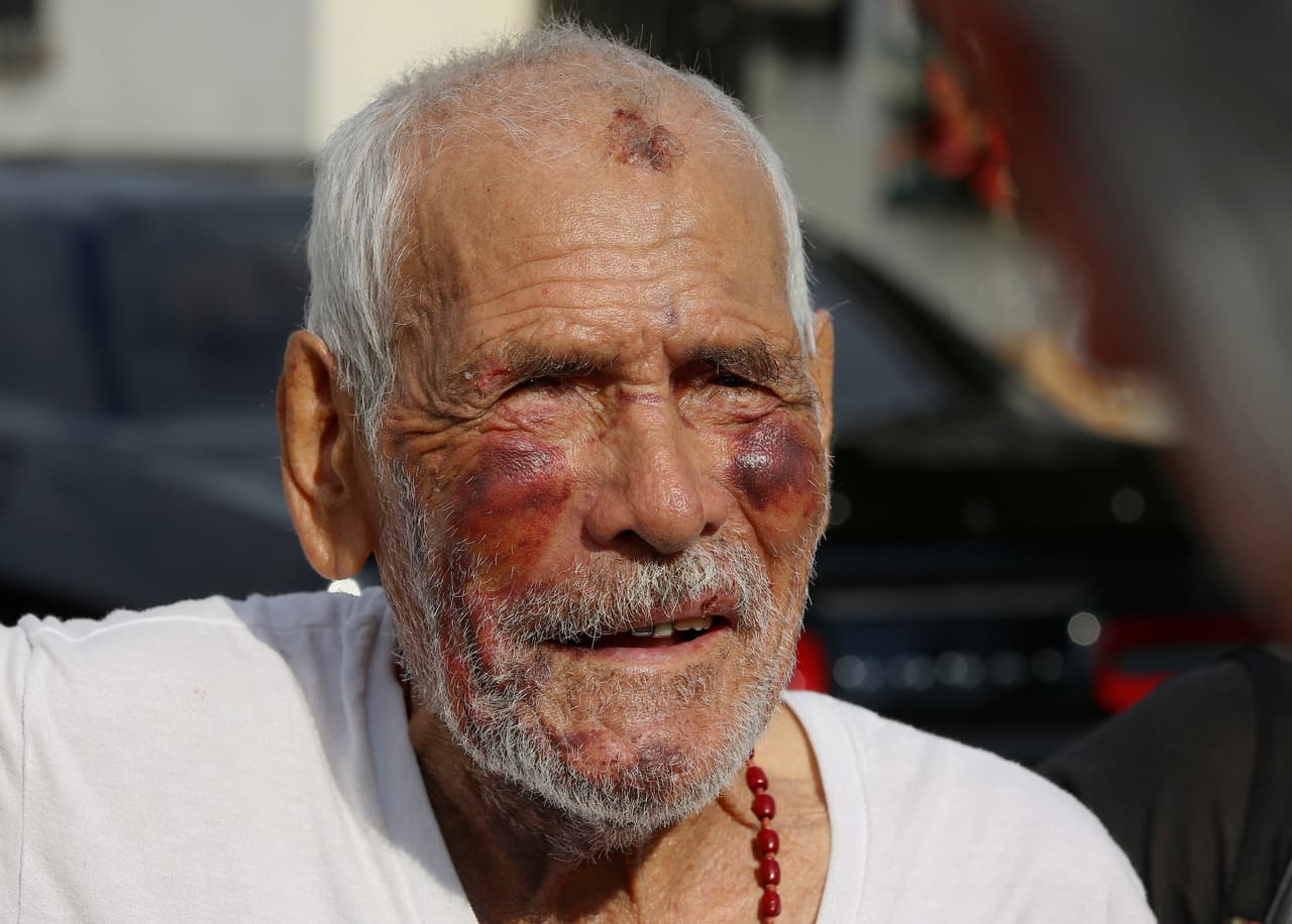 Rodríguez salió a caminar cuando fue golpeado la noche del 4 de julio de 2018 en una acera en un área no incorporada de Willowbrook, en el sur de California. Un testigo dijo que un asaltante golpeó a Rodríguez varias veces en la cabeza con un ladrillo y que, al parecer, varios hombres también se unieron al ataque. Foto de archivo julio,11 2018 (AP Photo/Damian Dovarganes)