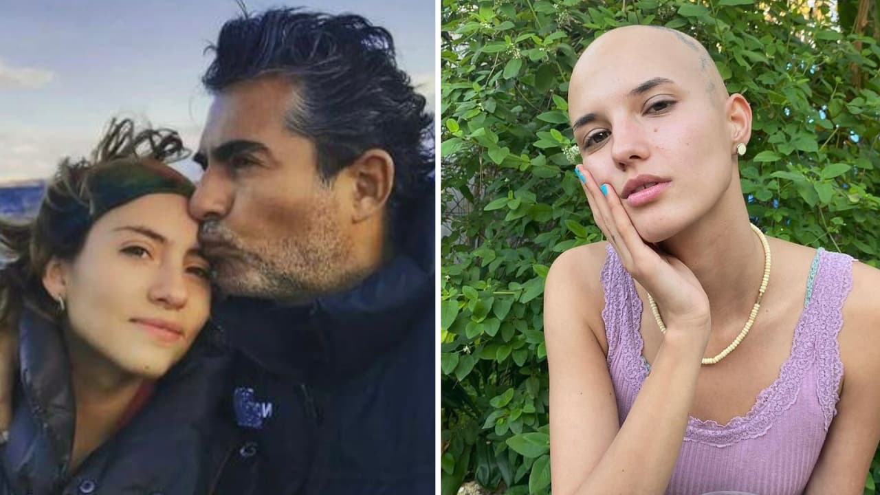Novia de Camila Araiza vivió 24 años ocultando su alopecia, ahora presume con orgullo su cabeza rapada
