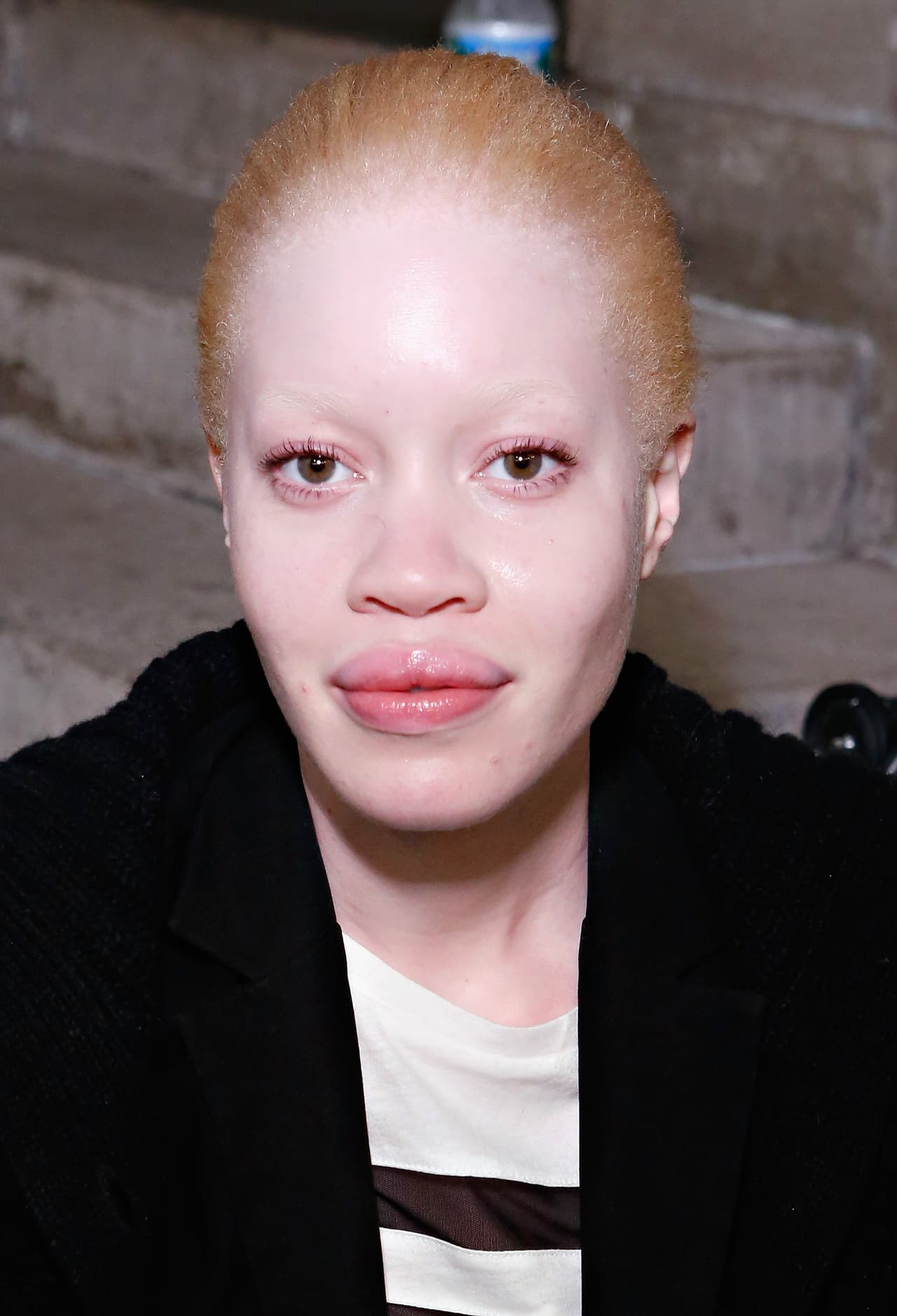 El albinismo de Diandra Forrest es motivo de persecución en algunos países africanos. Afortunadamente, esta modelo ha convertido su condición en una ventaja para su carrera sobre las pasarelas. Cada vez son más los modelos albinos que logran contratos con firmas de moda.