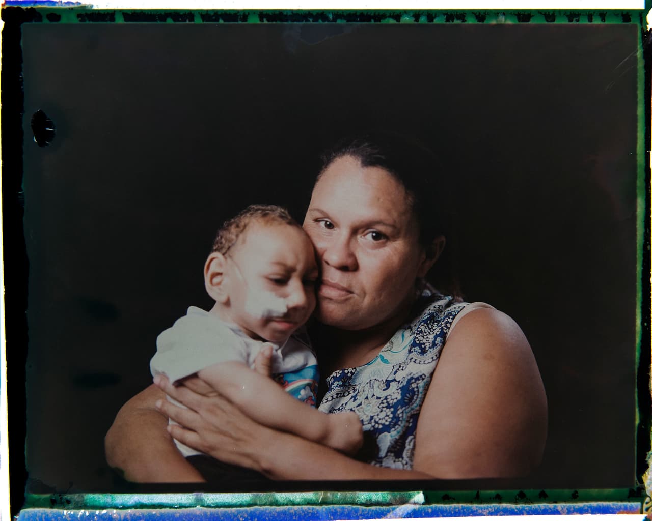 Esta foto muestra a Solange Ferreira mientras carga a su bebé de 1 año de edad, 
<a href="http://www.univision.com/noticias/alarma-en-brasil-por-rapido-incremento-de-recien-nacidos-con-microcefalia-video">Jose Wesley</a>. El pequeño adquirió fama cuando fotos de él dentro de una cubeta de agua se hicieron virales y se convirtieron en una imagen emblemática de la epidemia del Zika en Brasil. Solange descubrió que su 
<a href="http://www.univision.com/noticias/alarma-en-brasil-por-rapido-incremento-de-recien-nacidos-con-microcefalia-video">“bebé cubeta”</a>, como lo apodaron, se calma cuando está rodeado de agua.