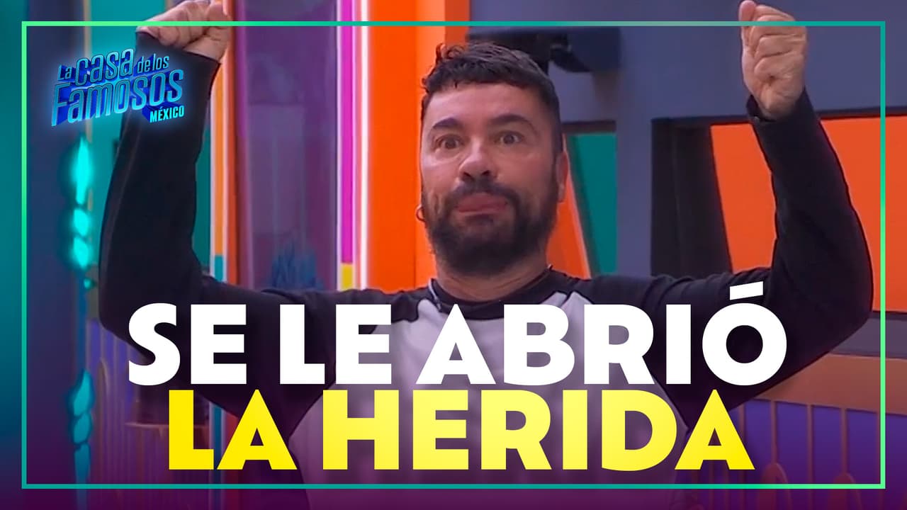 Shiky cuenta cuando se le cayeron las grapas de su operación en la escuela