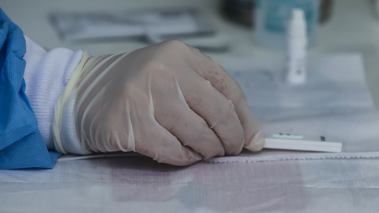 <b>Varón explica que es precisamente los síntomas a largo plazo lo que caracteriza al covid-19. </b>Él lo describe como un "virus tan traicionero debido a que cualquier síntoma que puedas tener puede estar relacionado al covid-19 prolongado". 
<br>