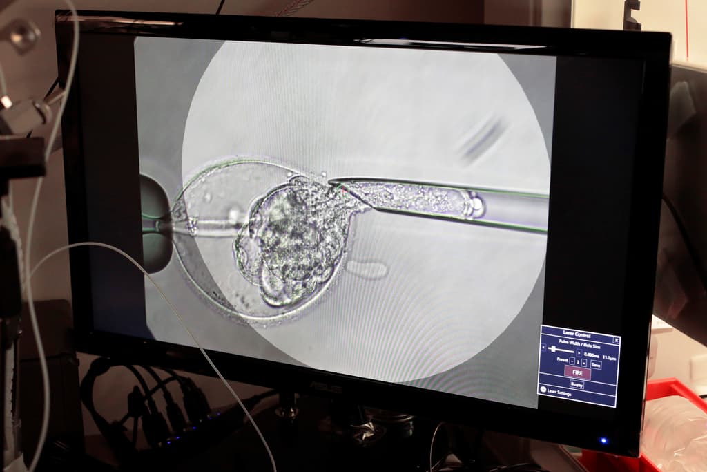 Alabama protege a las clínicas de fecundación in vitro: en qué consiste la ley