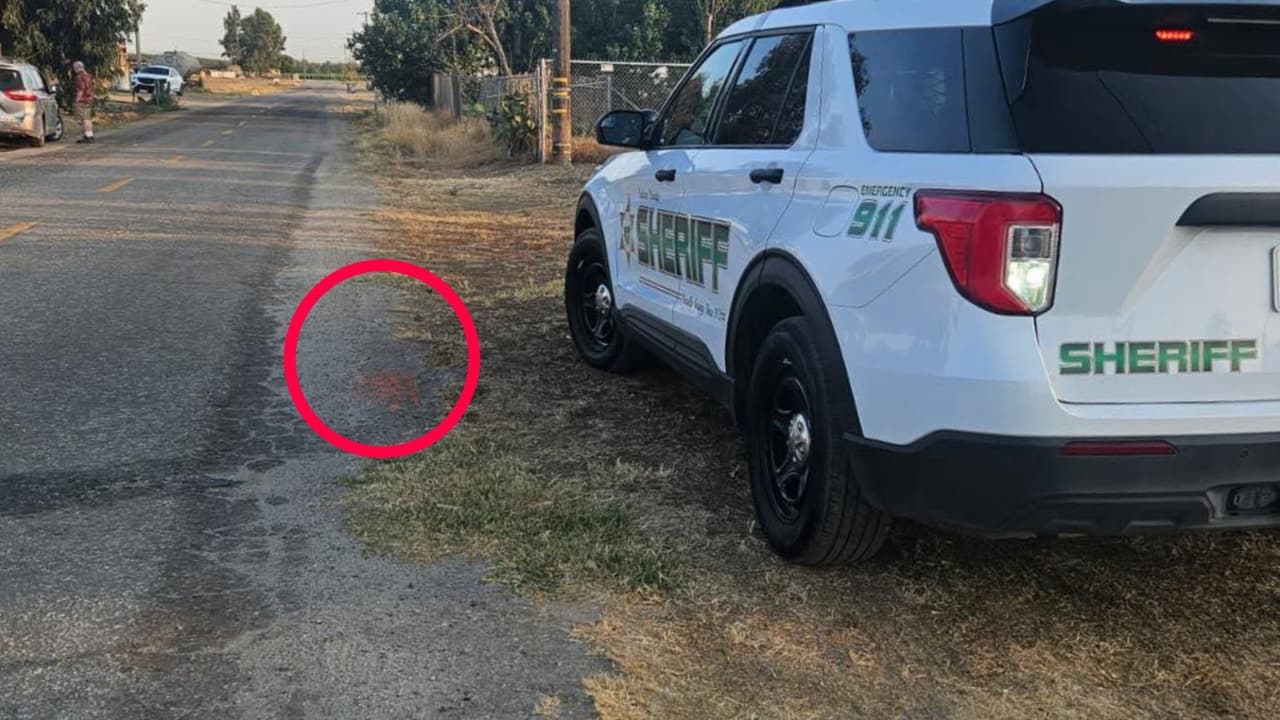 Niño pierde los dedos de su mano tras un accidente con fuegos artificiales en Goshen