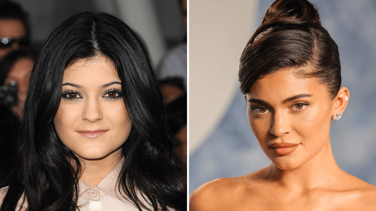  Kylie Jenner para en seco las críticas por sus rellenos labiales: “No me arrepiento”