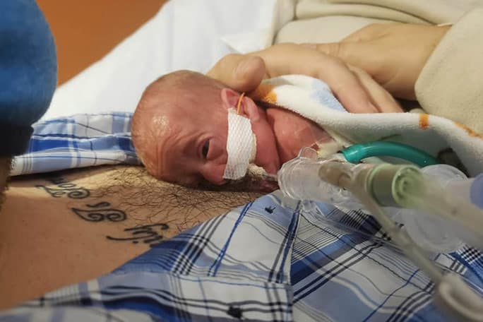 El equipo de neonatología del 
<a href="https://www.childrensmn.org/locations/woodbury/" target="_blank">Children’s Hospital de Minnesota</a> les dio un 0% de probabilidad de supervivencia del pequeño Richard. Sus padres, Beth y Rick no pudieron quedarse en el hospital para estar cerca de su bebé debido a la pandemia de 
<a href="https://www.univision.com/temas/coronavirus">covid-19</a>.