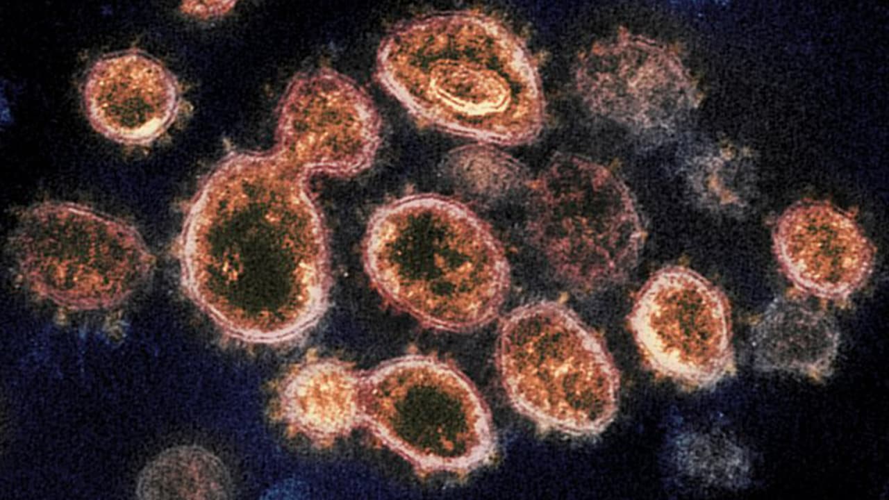 ¿Es más contagiosa? Esto dicen expertos sobre la variante Mu del coronavirus