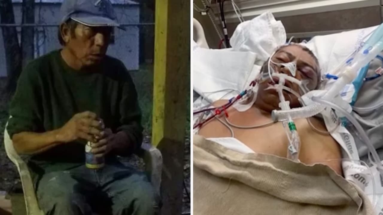 Un vecino vio el ataque e intentó alejar a los animales, pero Vásquez ya estaba mal herido, tanto que los médicos tuvieron que amputarle sus piernas y brazos.