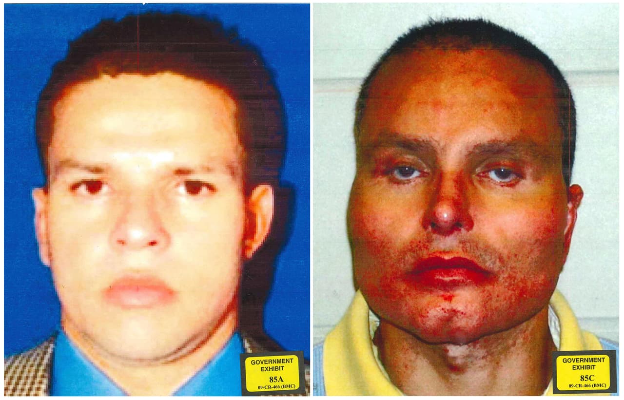 Fotografías de Juan Carlos Ramírez Abadía, alias ‘Chupeta’ y exlíder del cartel colombiano del Norte del Valle, antes y después de varias cirugías plásticas que le deformaron el rostro. Este narcotraficante declaró en el juicio que con la ayuda de 'El Chapo' pudo exportar más de 400 toneladas de cocaína a EEUU y
<a href="https://www.univision.com/noticias/narcotrafico/sicario-colombiano-habla-de-sus-negocios-con-el-chapo-y-confiesa-150-asesinatos-en-juicio-del-narco"> <u>que sobornó a un equipo élite de la Policía de Colombia y a oficiales de la DEA que realizaban investigaciones en su país</u></a>.