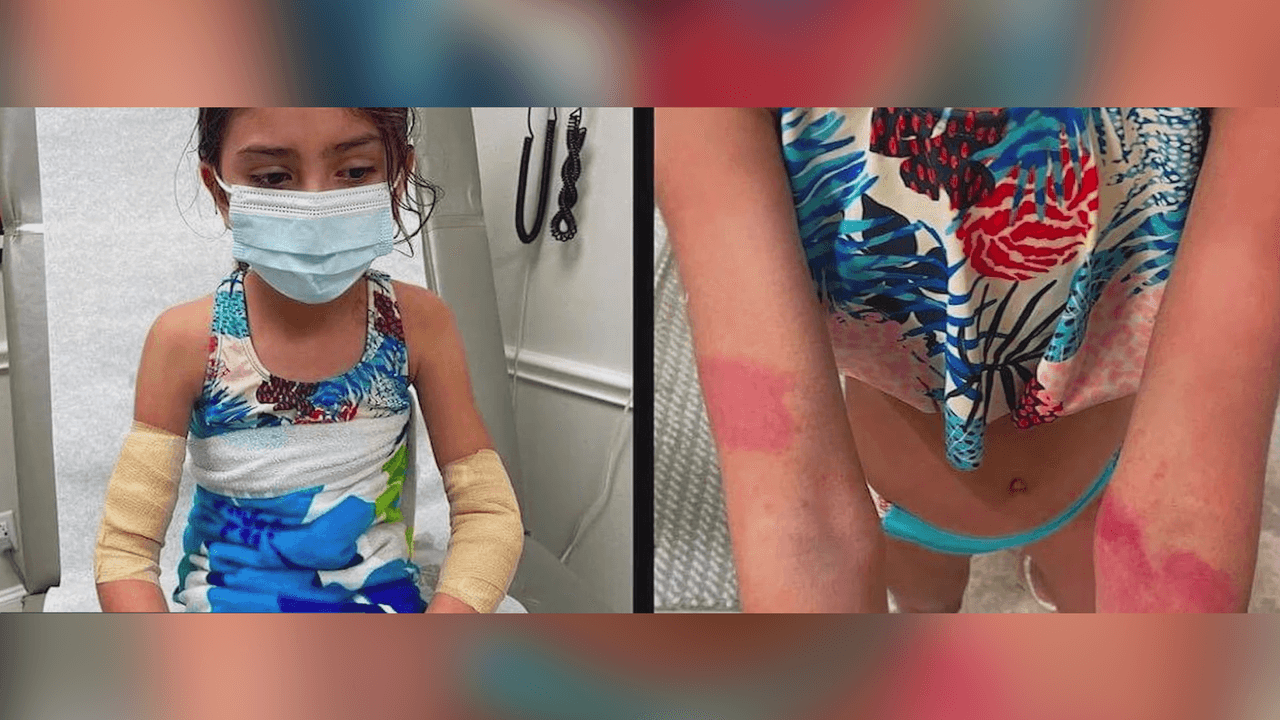 La presencia de medusas en las playas pueden causar el pánico entre los bañistas debido a las picaduras que pueden sufrir las personas si tienen contacto con estos animales.
<br>
<br>Pero, ¿sabe usted qué hacer si es picado y cómo puede evitarlas?
