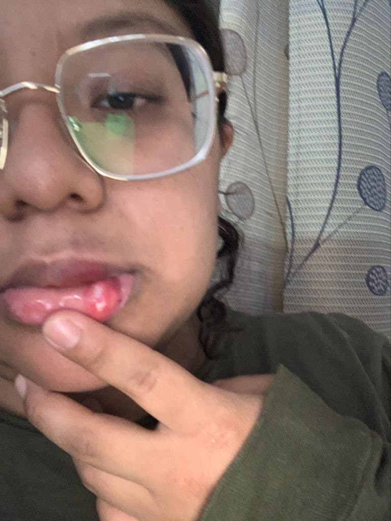Su esposa también fue golpeada.