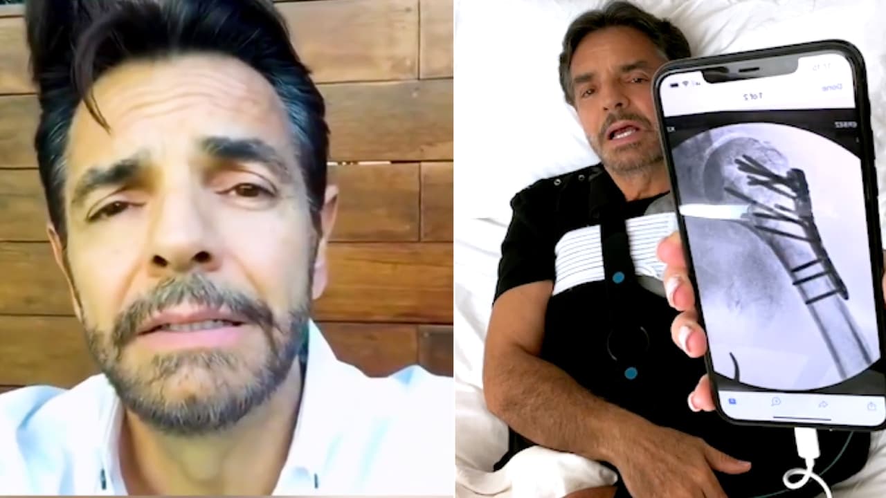 “Lloro por todo”: Eugenio Derbez con un nudo en la garganta al dar detalles de su accidente en el hombro